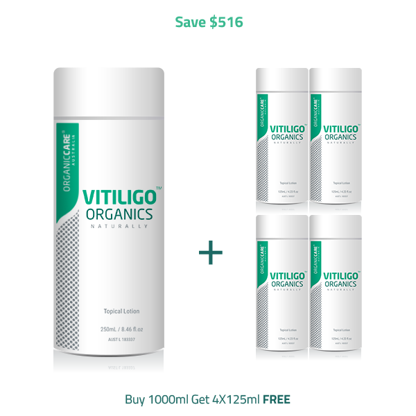 1500ml  Vitiligo Organics