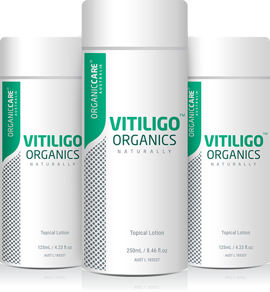 Vitiligo Organics™ Original  GMP Manufactured In Australia  eBay